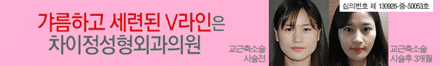 작은얼굴 브라인을 위한 교근 축소술