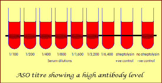 사슬알균 감염 Antistreptolysin O antibody (ASO) - 검사방법 - 바오로천사