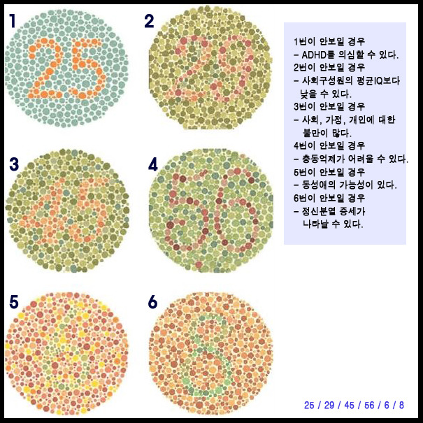 색맹, 색약치료가능할까요? 색맹테스트 해보세요^^ - 시력상담 Q&A------★ - 소방공무원을 사랑하는 모임 :D [소사모]