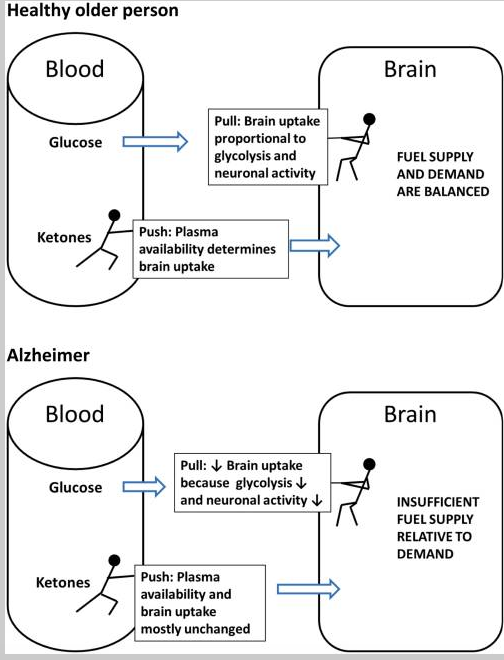 Re:Re:Re:Can Ketones Help Rescue Brain Fuel Supply in Later Life ...