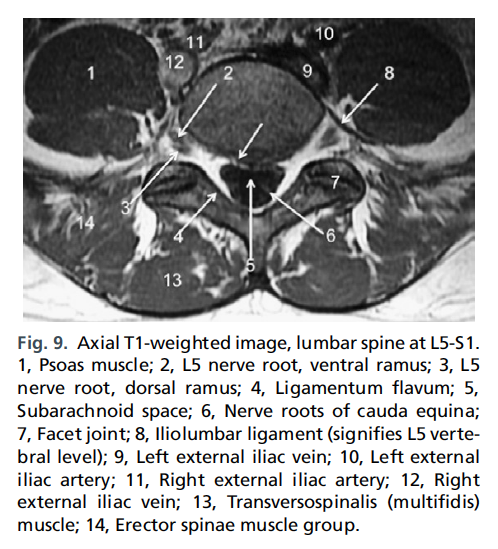 정상 척추사진 MRI - 정리해야.. - x-ray,ct, mri 진단 - 치료적 맞춤운동, 비타미네, 영성 연구소