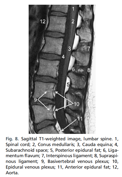 정상 척추사진 MRI - 정리해야.. - x-ray,ct, mri 진단 - 치료적 맞춤운동, 비타미네, 영성 연구소