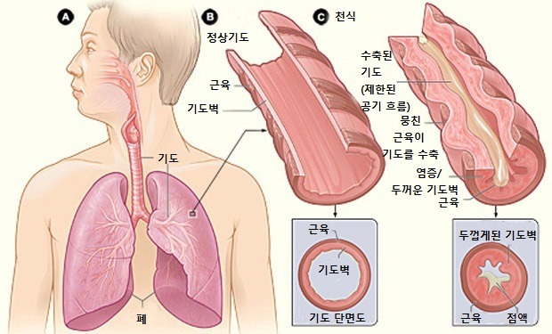 윤상인두근육