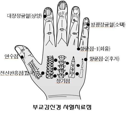 6월 월례회 세미나(29일) 사혈요법 - 공지게시판 - 대한의 자랑스런 대체의학 광명건강 광명의학 KMHEALTH