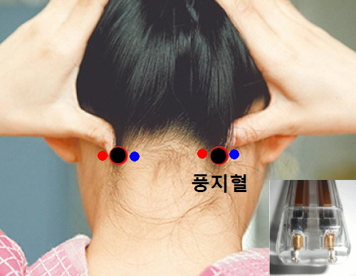 녹내장의 발생 원인과 제니센 터치 치료방법 - 제니센 터치 건상상담 - 마라네츄럴 코리아 & 몸신 자석건강법 따라하기