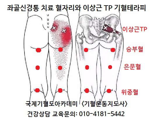 좌골신경통 치료에 좋은 교정운동 (동영상) - 척추교정 신체평형 잠재의식 자율신경운동 - 기혈테라피 - 자세교정 기혈 테라피
