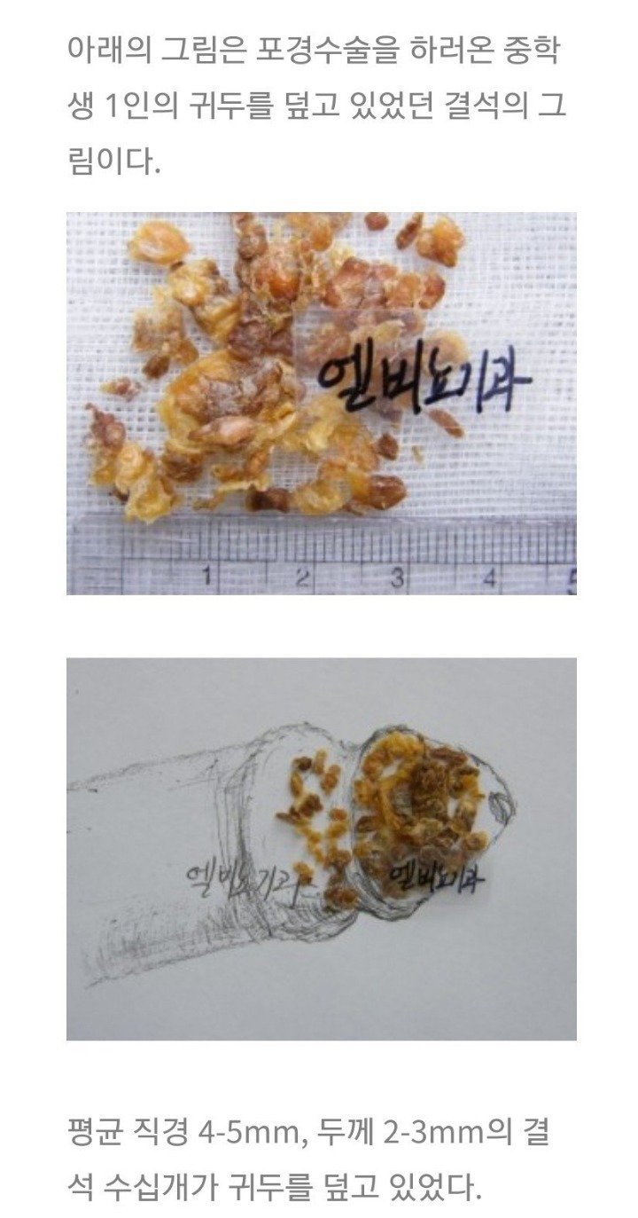 약혐)((개더러움주의)) 노포경 제대로 안씻어서 - 악플달면 쩌리쩌려버려 - ＊여성시대＊ 차분한 20대들의 알흠다운 공간