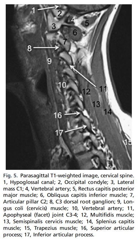정상 척추사진 MRI - 정리해야.. - x-ray,ct, mri 진단 - 치료적 맞춤운동, 비타미네, 영성 연구소