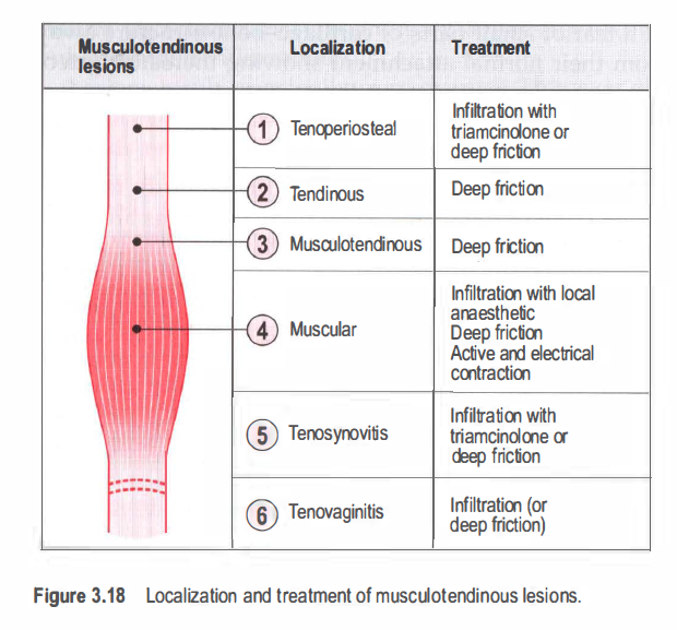 Supraspinatus Tendinosis Discount Price Save Jlcatj Gob Mx