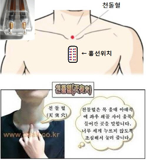 흉선 - ├……제니센 처방전 - 마라셀 힐링 라이프 & 몸신 자석건강법 따라하기