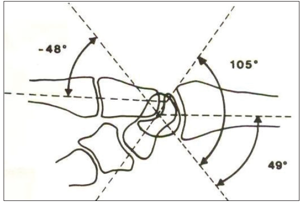 손목 불안정(wrist instability) - 건.물.사 공부방 - 건강한 물리치료사